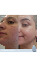 Load image into Gallery viewer, Vida Glow Advanced Repair - Clear