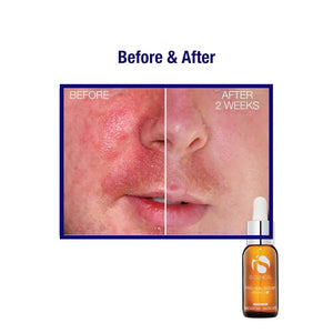 IS Clinical Pro-Heal Serum Advance+