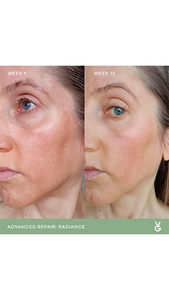 Vida Glow Radiance Capsules